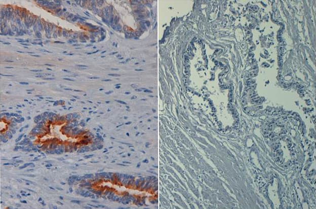 Monoclonal Mouse anti-Human AKT1 Antibody (clone 17F6.B11, Biotin, phospho-Ser473, IHC, IF, WB)