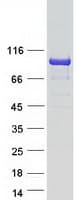 Human KLHL29 Protein (Recombinant Myc-DDK (Flag))