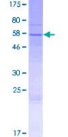 Human PROL1 Protein (Recombinant GST)