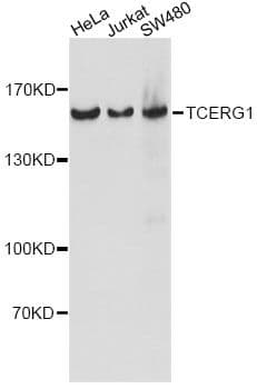 TCERG1 / CA150 Antibody