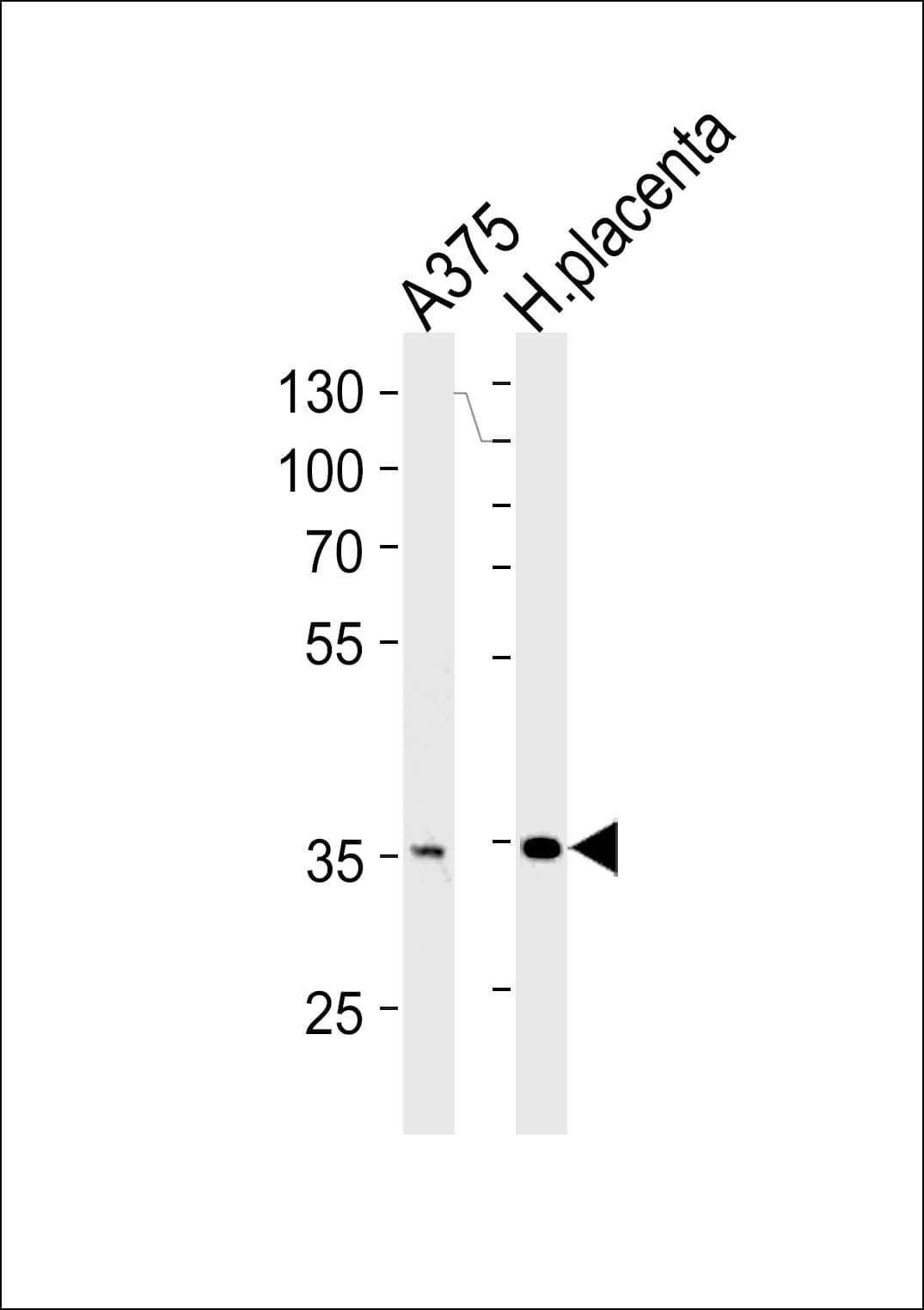 AKR1B1 / Aldose Reductase Antibody (aa290-316)