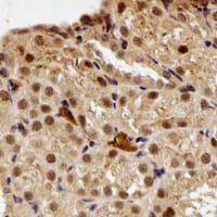 PPL / Periplakin Antibody