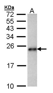 Polyclonal Rabbit anti-Human CARHSP1 Antibody (aa1-147, IHC, WB)