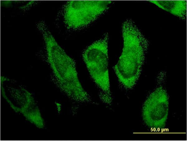 MLX / TCFL4 Antibody (clone 1C3)