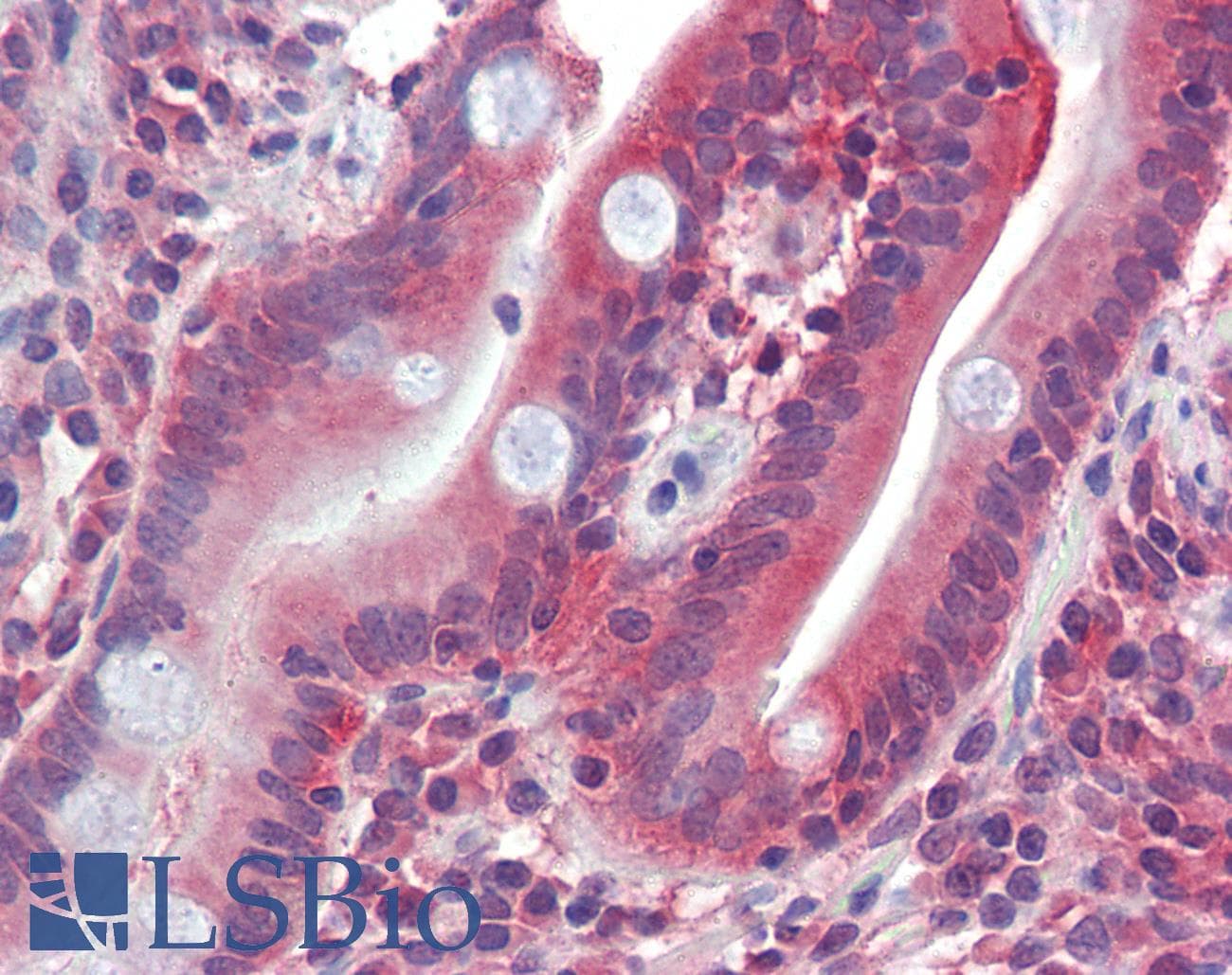 IHC-plus™ SLC2A5 / GLUT5 Antibody (aa482-493)
