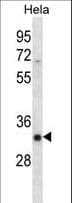 Polyclonal Rabbit anti-Human SFRS7 / 9G8 Antibody (aa69-98, IHC, WB)