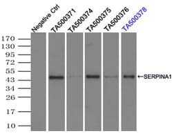 SERPINA1 / Alpha 1 Antitrypsin Antibody (clone 11G2, Carrier-free)