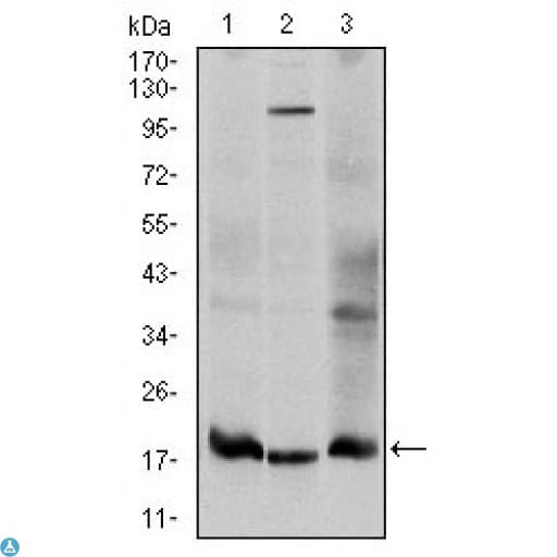 Monoclonal Mouse anti-Human UBE2I / UBC9 Antibody (IHC, IF, WB)