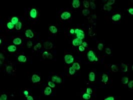 Monoclonal Mouse anti-Human PADI4 / PAD4 Antibody (clone OTI4H5, IHC, IF, WB)