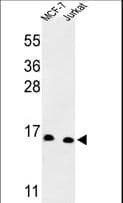 IHC-plus™ SNRPD3 Antibody (aa99-126)