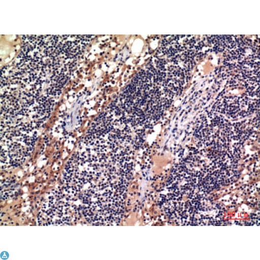 ADAM10 Antibody