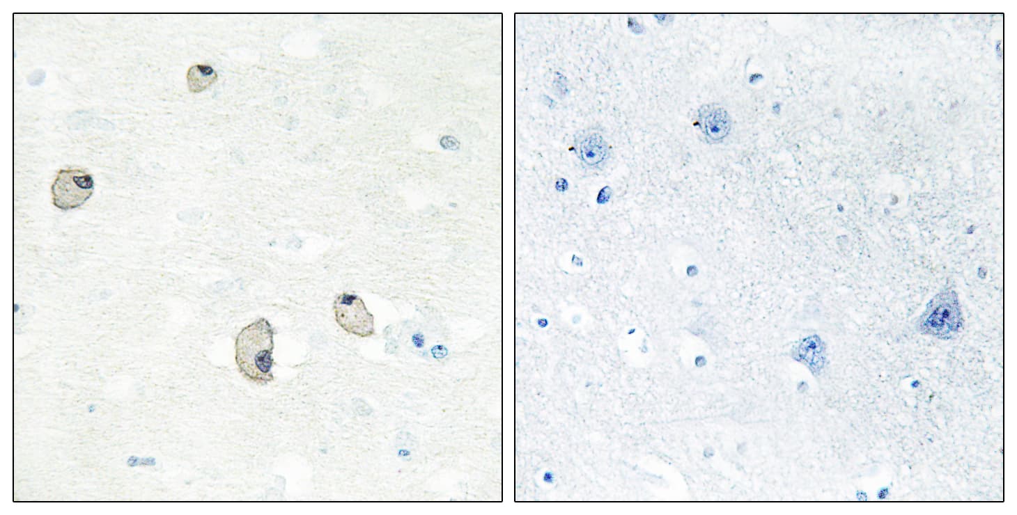 CDH22 / Cadherin 22 Antibody (aa111-160)