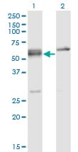 Monoclonal Mouse anti-Human SRSF6 / SRP55 Antibody (clone 5G6, WB)