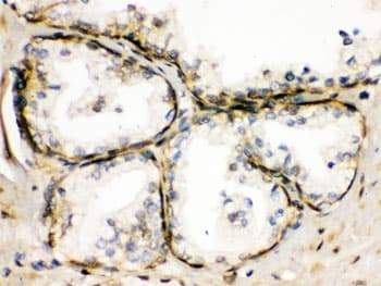 TRPM5 Antibody