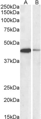 IHC-plus™ Polyclonal Goat anti-Human CREB1 / CREB Antibody (aa96-109, IHC, WB)