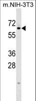 Polyclonal Rabbit anti-Human KLHL12 Antibody (aa376-404, WB)