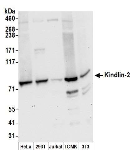 KIND2 / FERMT2 Antibody (aa175-225)
