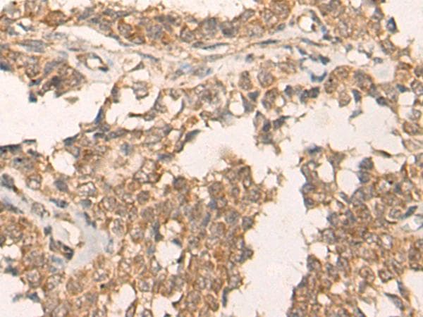 ATR Antibody