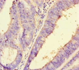 Polyclonal Rabbit anti-Human PDLIM5 / LIM Antibody (IHC, IF)
