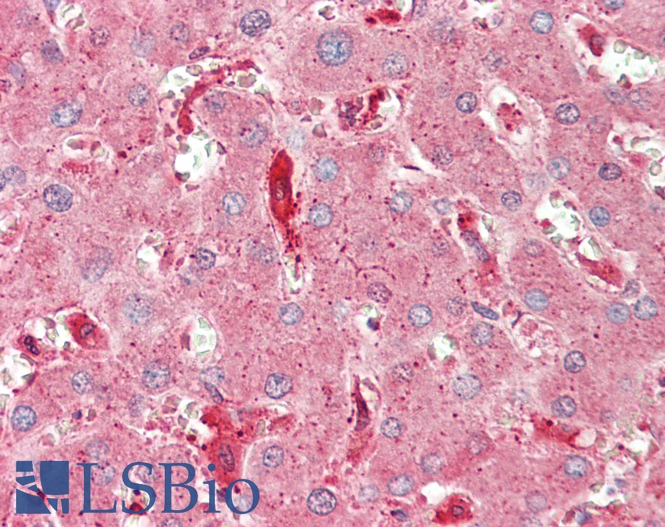 CHMP2A Antibody (HRP)