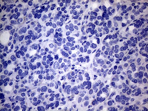 p16INK4a / CDKN2A Antibody (clone OTI5H8)
