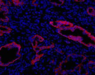 Oval Cell Marker MIC1 Antibody (clone MIC1-1C3)