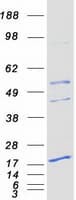 Human PEMT Protein (Recombinant Myc-DDK (Flag))