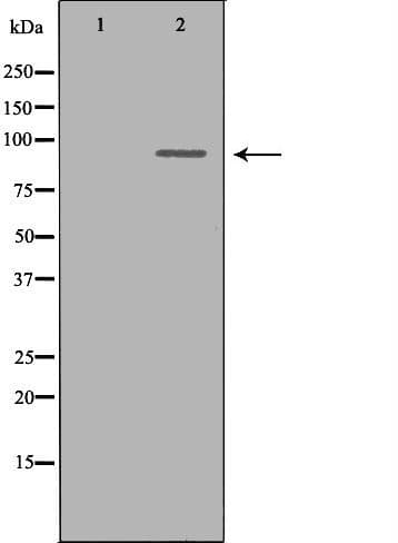 OCA2 / P protein Antibody