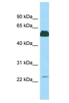 KRT85 / Keratin 85 / KRTHB5 Antibody (aa301-350)