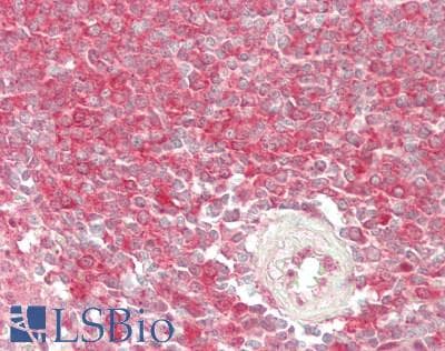 IHC-plus™ VCP Antibody (aa726-755)