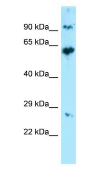 KRT71 / Keratin 71 Antibody (aa192-241)
