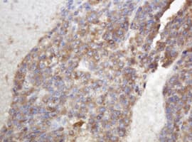 Monoclonal Mouse anti-Human TAPBPL / TAPBPR Antibody (clone OTI3D8, IHC, WB)