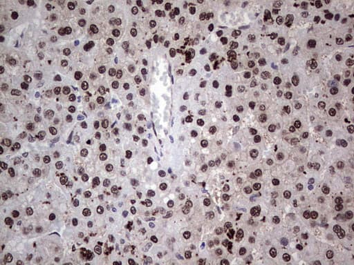 Monoclonal Mouse anti-Human RAD23B / HR23B Antibody (clone OTI7G10, aa1-253, IHC, WB)