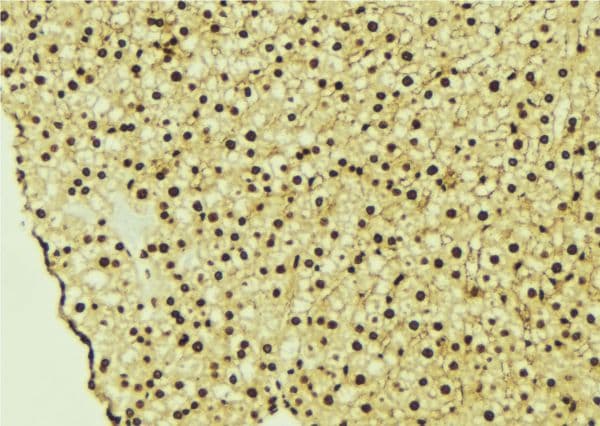 CASK Antibody