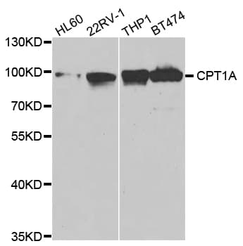 CPT1A Antibody