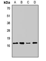 AGTRAP / ATRAP Antibody