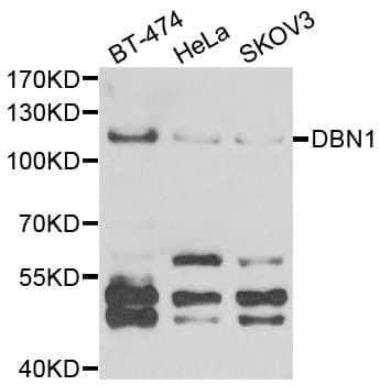 DBN1 / Drebrin Antibody