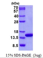 Human COX5A Protein (Recombinant His)