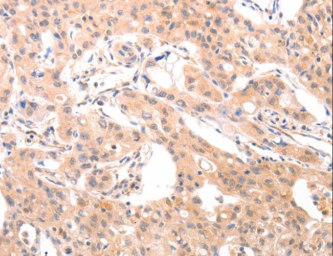 ACO1 / Aconitase Antibody