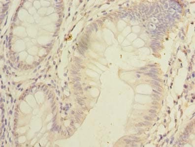 SSMEM1 / C7orf45 Antibody