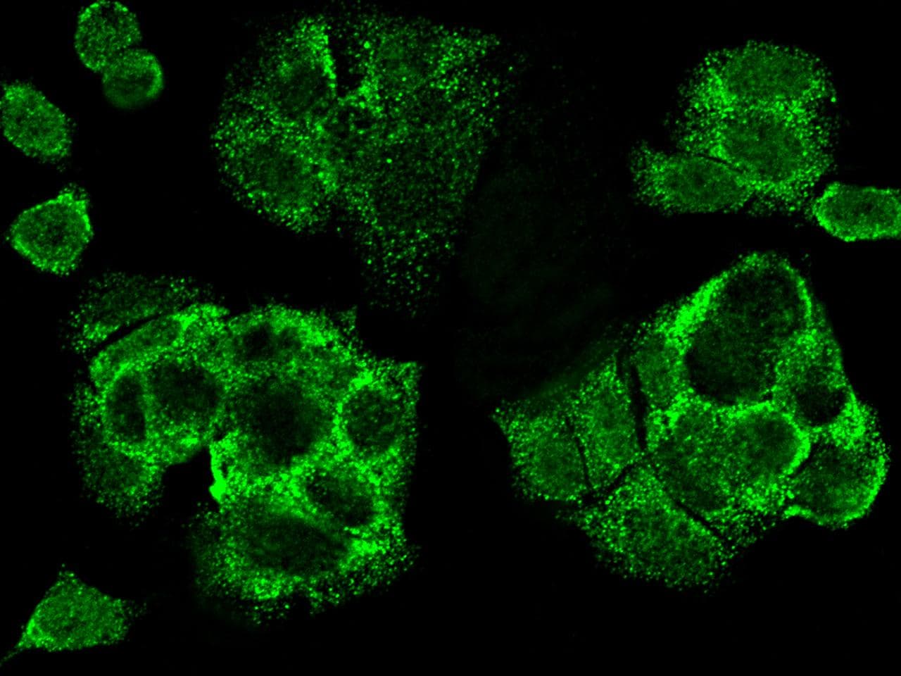 CDCA3 Antibody (Preservative Free)