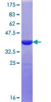 Human NGEF / EPHEXIN Protein (Recombinant GST, N-terminus)