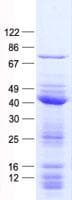 Human GLS2 / Glutaminase 2 Protein (Recombinant His, N-Terminal)