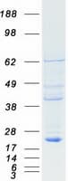 Human RBBP9 Protein (Recombinant Myc-DDK (Flag))