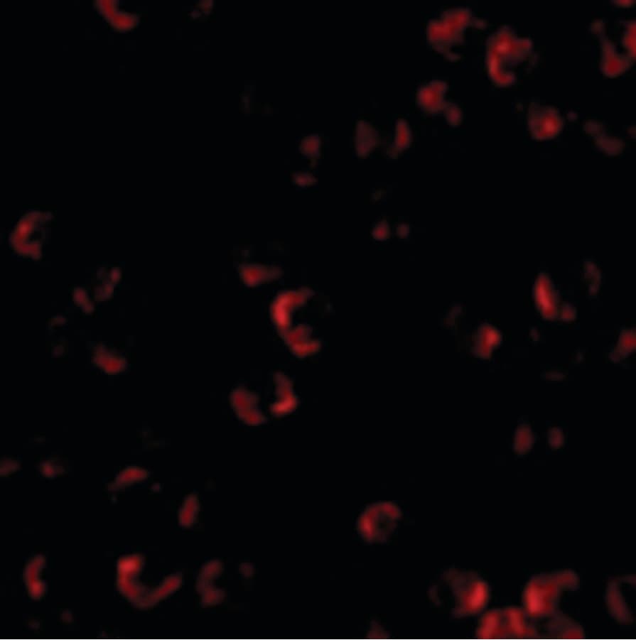 Polyclonal Rabbit anti-Human Kinesin 5A / KIF5A Antibody (IHC, IF, WB)