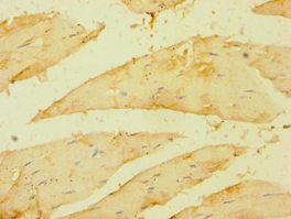 Polyclonal Rabbit anti-Human BRCC3 / BRCC36 Antibody (aa1-316, IHC, WB)