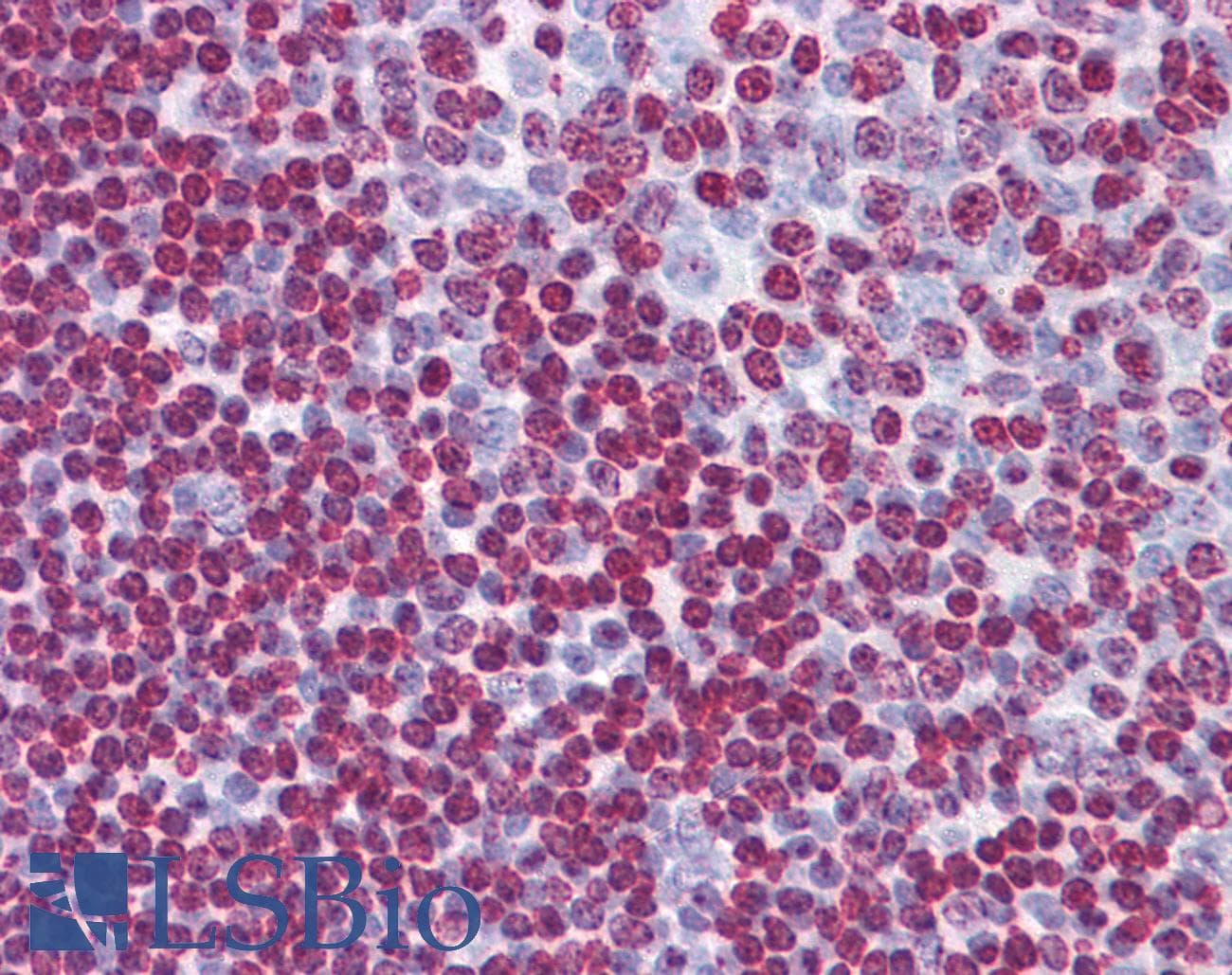 IHC-plus™ Monoclonal Mouse anti-Human ATR Antibody (clone 1E9, IHC)