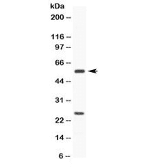 CYP3A4 / Cytochrome P450 3A4 Antibody