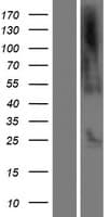 C21orf62 Protein (Over-Expression Lysate Myc-DDK (Flag))