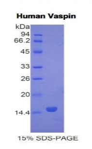 Human SERPINA12 / Vaspin Protein (Recombinant His)